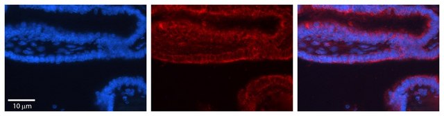 Anti-TRIM32 antibody produced in rabbit affinity isolated antibody