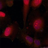 Anti-STAT3 (Ab-705) antibody produced in rabbit affinity isolated antibody