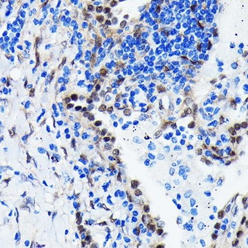 Anti-YAP1 antibody produced in rabbit