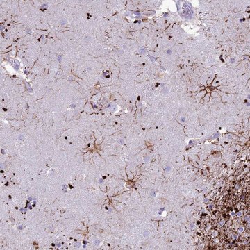 Anti-IFT172 antibody produced in rabbit Prestige Antibodies&#174; Powered by Atlas Antibodies, affinity isolated antibody, buffered aqueous glycerol solution