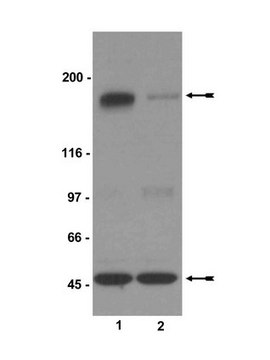 Anti-phospho-NR2B (Ser1303) Antibody Upstate&#174;, from rabbit