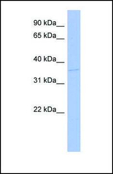 Anti-TLX3, (N-terminal) antibody produced in rabbit affinity isolated antibody