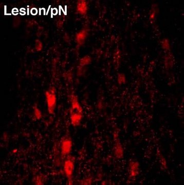 Anti-Nerve Growth Factor Antibody, pro serum, Chemicon&#174;