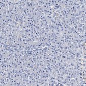 Anti-SEZ6 antibody produced in rabbit Prestige Antibodies® Powered by Atlas Antibodies, affinity isolated antibody, buffered aqueous glycerol solution