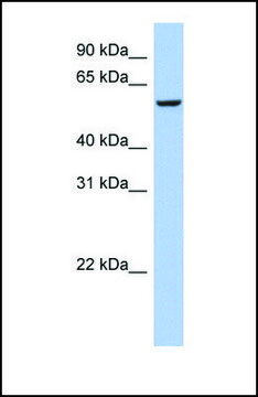 Anti-FBXO33 antibody produced in rabbit affinity isolated antibody