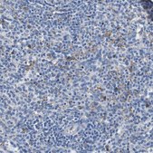 Anti-IGSF8 antibody produced in rabbit Prestige Antibodies® Powered by Atlas Antibodies, affinity isolated antibody, buffered aqueous glycerol solution