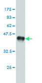Monoclonal Anti-AK1 antibody produced in mouse clone M1, purified immunoglobulin, buffered aqueous solution