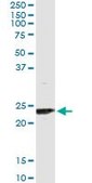 Monoclonal Anti-UBE2T antibody produced in mouse clone 4G1-4C2, purified immunoglobulin, buffered aqueous solution