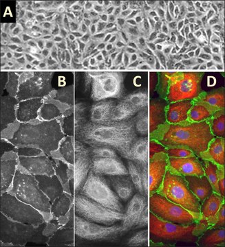 Human Mammary Epithelial Cells: HMEpC, adult