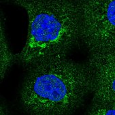 Anti-SLC25A24 antibody produced in rabbit Prestige Antibodies® Powered by Atlas Antibodies, affinity isolated antibody, buffered aqueous glycerol solution