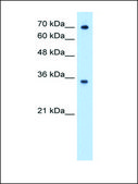Anti-FCGRT antibody produced in rabbit affinity isolated antibody