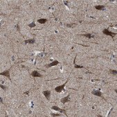 Anti-SLC35F1 antibody produced in rabbit Prestige Antibodies® Powered by Atlas Antibodies, affinity isolated antibody, buffered aqueous glycerol solution