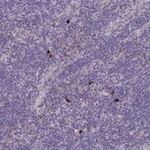 Anti-MRGPRX2 antibody produced in rabbit Prestige Antibodies® Powered by Atlas Antibodies, affinity isolated antibody, buffered aqueous glycerol solution