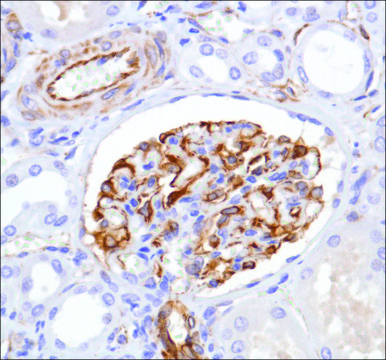 Anti-Nestin antibody, Rabbit monoclonal recombinant, expressed in proprietary host, clone SP103, affinity isolated antibody