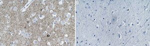 Anti-α-Synuclein Antibody, clone Syn211 ZooMAb® Mouse Monoclonal recombinant, expressed in HEK 293 cells