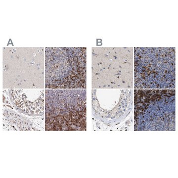 Anti-GIMAP4 antibody produced in rabbit Prestige Antibodies&#174; Powered by Atlas Antibodies, affinity isolated antibody, buffered aqueous glycerol solution