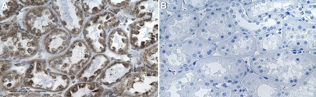 Anti-Notch 3 Antibody, clone 1G17 ZooMAb&#174; Rabbit Monoclonal recombinant, expressed in HEK 293 cells