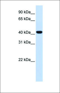 Anti-FOXD1 antibody produced in rabbit affinity isolated antibody