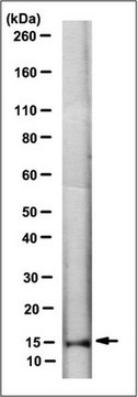 Anti-Gamma-synuclein (SNCG), clone 3D2.1 Antibody clone 3D2.1, from mouse