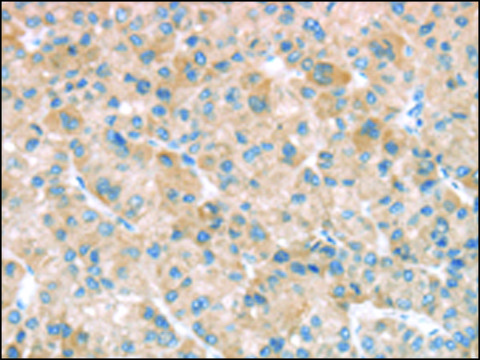 Anti-SFTPA1 affinity isolated antibody