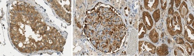 Anti-Calpastatin Antibody, clone PI-11 (Ascites Free) clone PI-11, from mouse