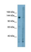 Anti-AHR IgG fraction of antiserum