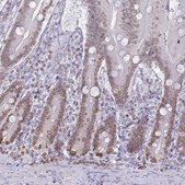 Anti-DHX37 antibody produced in rabbit Prestige Antibodies® Powered by Atlas Antibodies, affinity isolated antibody, buffered aqueous glycerol solution