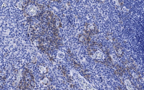 Anti-CD28 Antibody, clone 2N15 ZooMAb&#174; Rabbit Monoclonal recombinant, expressed in HEK 293 cells