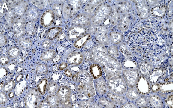 Anti-SMN Antibody, clone 2B1 ZooMAb&#174; Mouse Monoclonal recombinant, expressed in HEK 293 cells