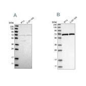 Anti-NPLOC4 antibody produced in rabbit Prestige Antibodies® Powered by Atlas Antibodies, affinity isolated antibody, buffered aqueous glycerol solution, Ab2