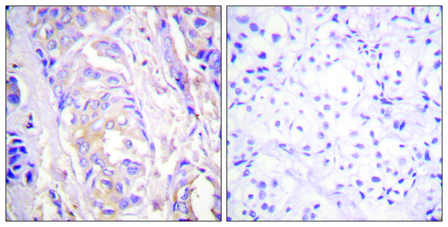 Anti-MEK1 antibody produced in rabbit affinity isolated antibody