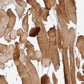 Anti-MYOM2 antibody produced in rabbit Prestige Antibodies® Powered by Atlas Antibodies, affinity isolated antibody, buffered aqueous glycerol solution