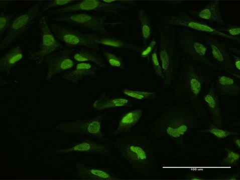 Anti-YY1 antibody produced in mouse purified immunoglobulin, buffered aqueous solution