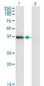 Monoclonal Anti-NKX2-5 antibody produced in mouse clone 3C1, purified immunoglobulin, buffered aqueous solution