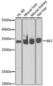 Anti-AK2 antibody produced in rabbit