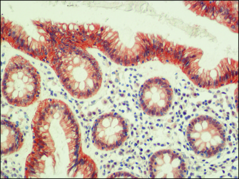 抗-封闭素抗体 来源于兔 affinity isolated antibody