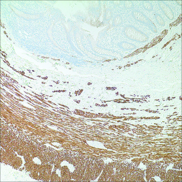 Desmin (D33) Mouse Monoclonal Antibody