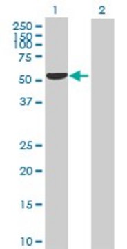 Anti-SERPINA7 antibody produced in rabbit purified immunoglobulin, buffered aqueous solution