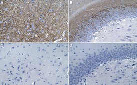 Anti-VGLUT1 Antibody, clone 3C10.2 ZooMAb® Mouse Monoclonal recombinant, expressed in HEK 293 cells