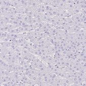 Anti-TMEM79 antibody produced in rabbit Prestige Antibodies® Powered by Atlas Antibodies, affinity isolated antibody, buffered aqueous glycerol solution