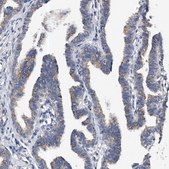 Anti-PPP5C antibody produced in rabbit Prestige Antibodies® Powered by Atlas Antibodies, affinity isolated antibody, buffered aqueous glycerol solution