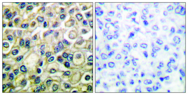 Anti-Claudin 1 antibody produced in rabbit affinity isolated antibody