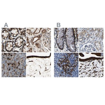 Anti-RRBP1 antibody produced in rabbit Prestige Antibodies&#174; Powered by Atlas Antibodies, affinity isolated antibody, buffered aqueous glycerol solution