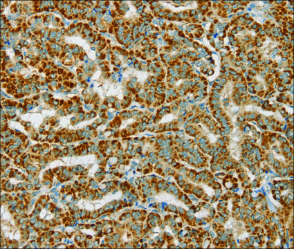 Anti-PDP1 antibody produced in rabbit affinity isolated antibody