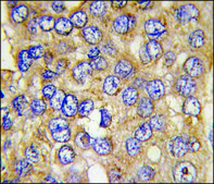 Anti-PFKFB4 (center) antibody produced in rabbit IgG fraction of antiserum, buffered aqueous solution