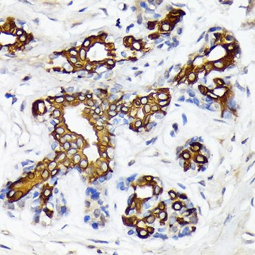 Anti-CYP26A1 antibody produced in rabbit