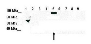 Anti-SMAD5 antibody produced in rabbit affinity isolated antibody