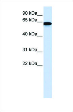 Anti-CHAT affinity isolated antibody