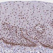 Anti-DDB2 antibody produced in rabbit Prestige Antibodies® Powered by Atlas Antibodies, affinity isolated antibody, buffered aqueous glycerol solution