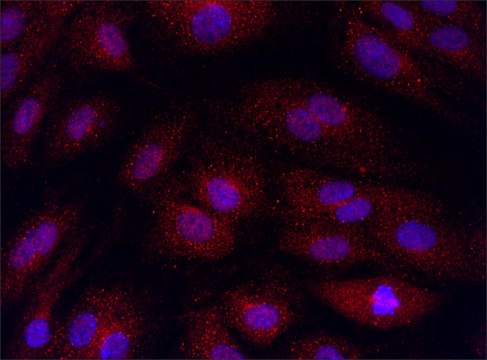 Anti-SMOX (151-165) antibody produced in rabbit IgG fraction of antiserum